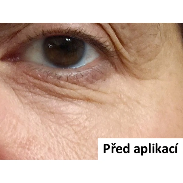 B-Selfie EYE - náplast pro vyplnění vrásek očního okolí - 1 ks (2 náplasti)