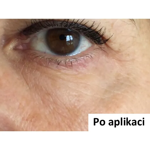 B-Selfie EYE - náplast pro vyplnění vrásek očního okolí - 1 ks (2 náplasti)