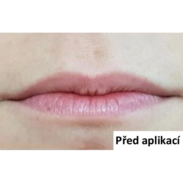 B-Selfie VOLUME - náplast pro vyplnění rtů - 1 ks (2 náplasti)