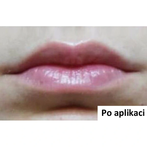 B-Selfie VOLUME - náplast pro vyplnění rtů - 1 ks (2 náplasti)